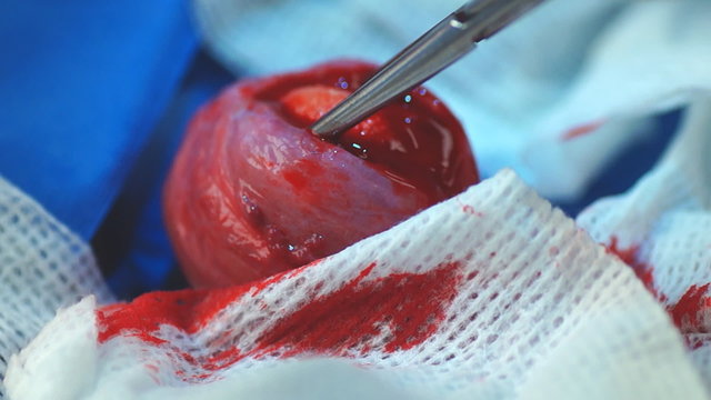 Extracting Large Stone From Bladder (Canine)