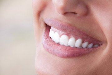 woman's smile showing perfect teeth