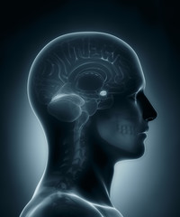 Amygdala medical x-ray scan