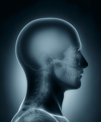 Skull medical x-ray scan