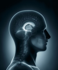 Ventricles medical x-ray scan