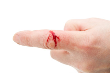 Flesh wound with  blood on male  finger