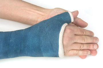 Broken wrist, arm with a blue fiberglass cast