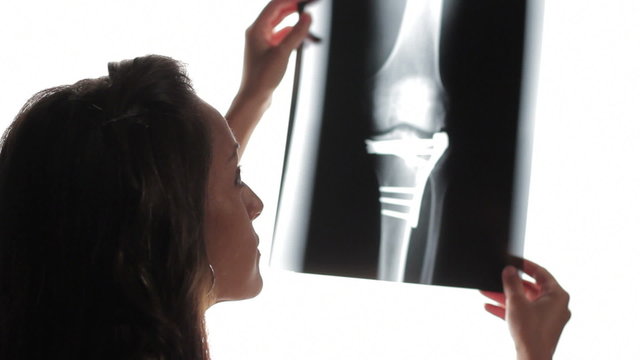Female doctor looking at x-ray
