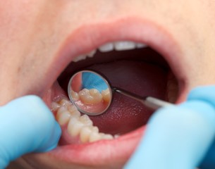 Extensive dental examination