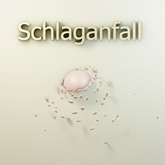 Schlaganfall - 3d Render