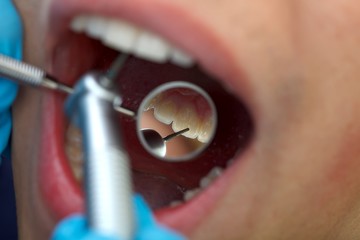 Dental drilling