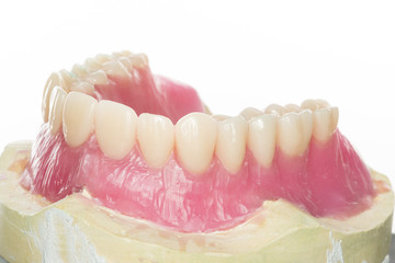 Zahnmodel - Totalprothese