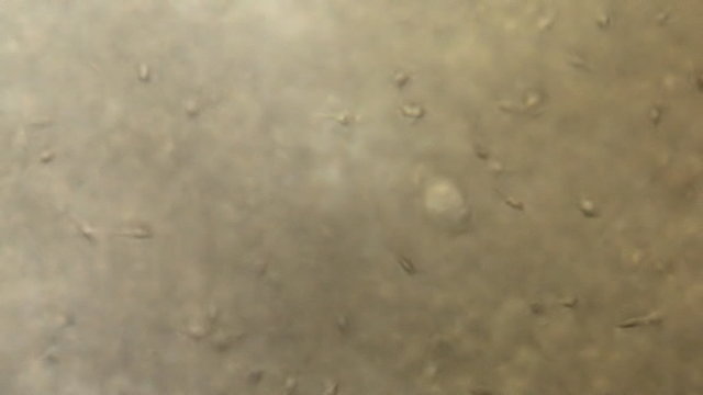 Clinic Sperm Sample