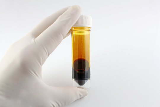 flasche jod mit hand