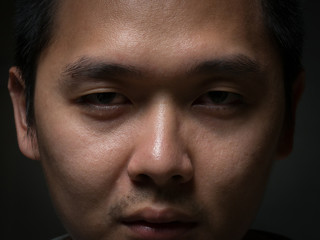 Obraz premium black eye sleep deprived