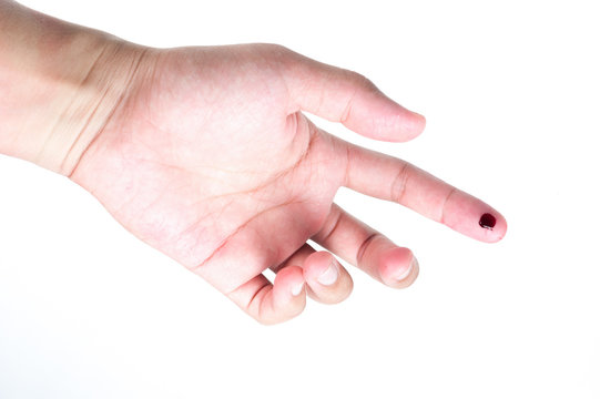 finger with blood isolated