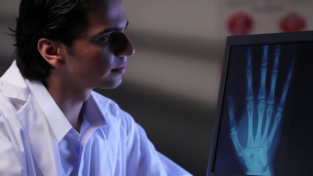Doctor looking at x-ray image of a hand on a computer