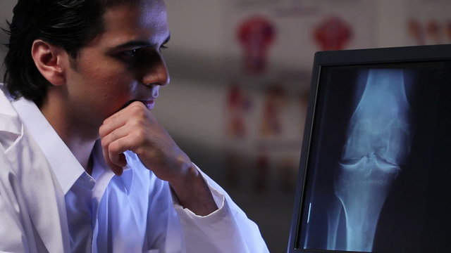 Doctor looking at x-ray image of a knee on a computer
