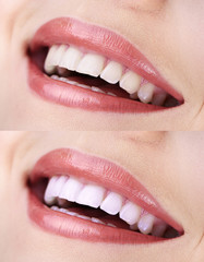 Woman smiling with teeth close-up