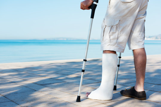 gipsbein im urlaub