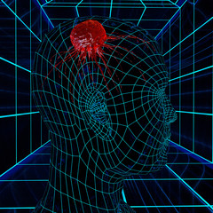 Hirntumor - 3D Render