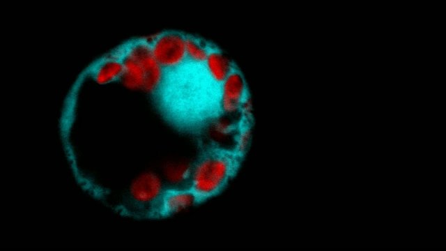 Protoplasts