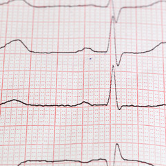 cardiogram