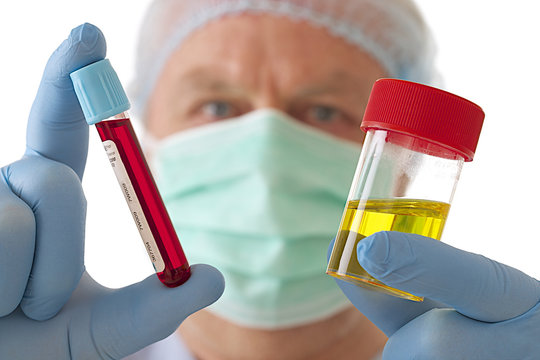 Analyse m&eacute;dicale - Sang & Urine
