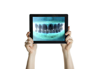 Dental closeup with tablet