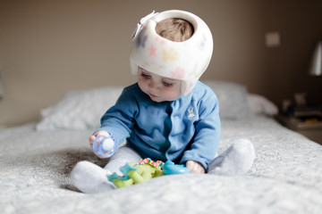 baby with helment for  Plagiocephaly