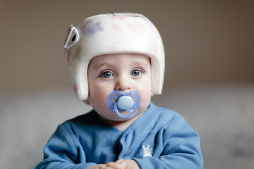 baby with helment for  Plagiocephaly