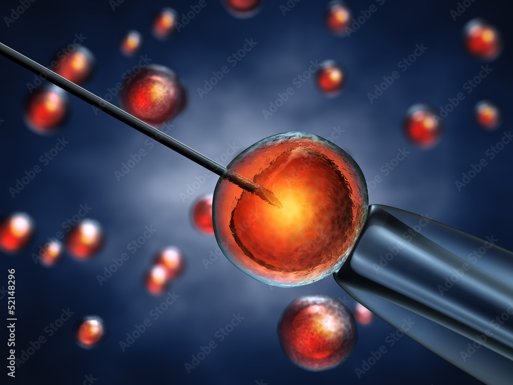 Wall mural intracytoplasmic sperm injection,in vitro fertilization