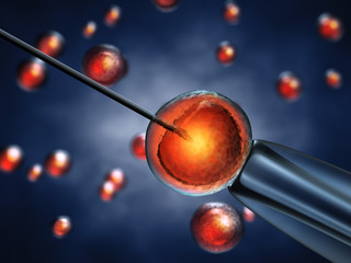 Intracytoplasmic sperm injection,In Vitro fertilization - obrazy, fototapety, plakaty