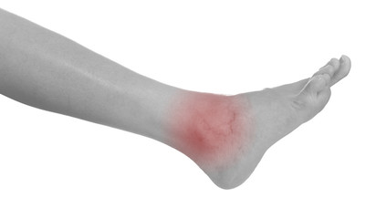 Acute pain in a woman ankle