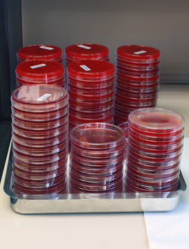 Microbiological media