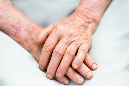 Elderly Hands