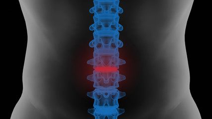 Lumbar vertebrae