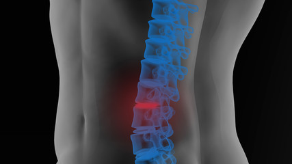 Pain in Lumbar vertebrae