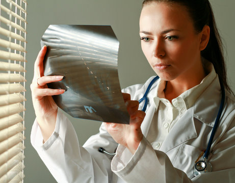 Woman is standing near window and examining x-ray