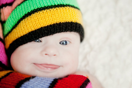 little baby in hat gnome with Downs syndrome