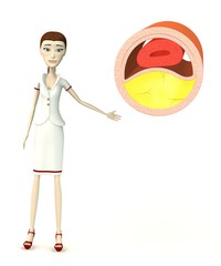 3d render of cartoon character with vein with cholesterol