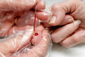 Blutabnahme von einem Finger | bloodtest.