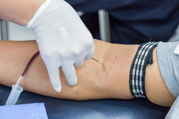 A large bore needle is inserted for blood donation