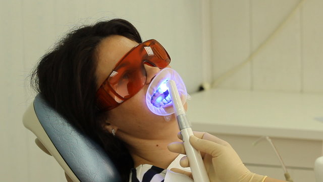Teeth Whitening. Activation of the gel polymerization light. 