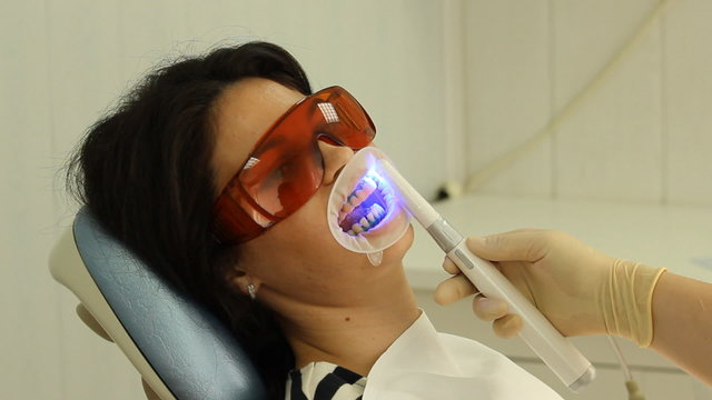 Teeth Whitening. Activation of the gel polymerization light. 