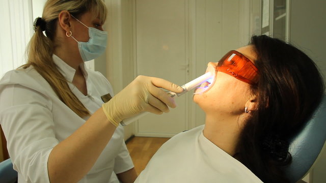 Teeth Whitening. Activation of the gel polymerization light 