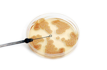 Penicillum fungi on agar plate