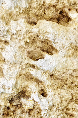 Osteoporose close up