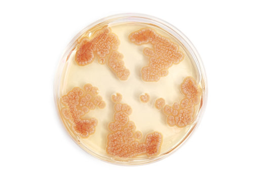 fungi on agar plate in laboratory