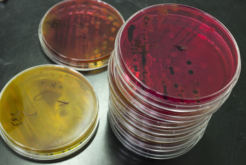 petri dish bacteria