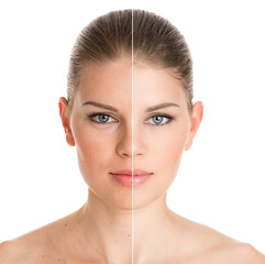 Before and after cosmetic operation. Woman portrait, isolated