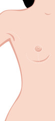 breast enlargement - obrazy, fototapety, plakaty