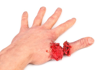 artificial human hand with cut out finger - 53386495