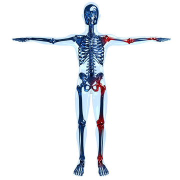 Full Human Skeleton 3D Concept With Joint Pain On Left Side